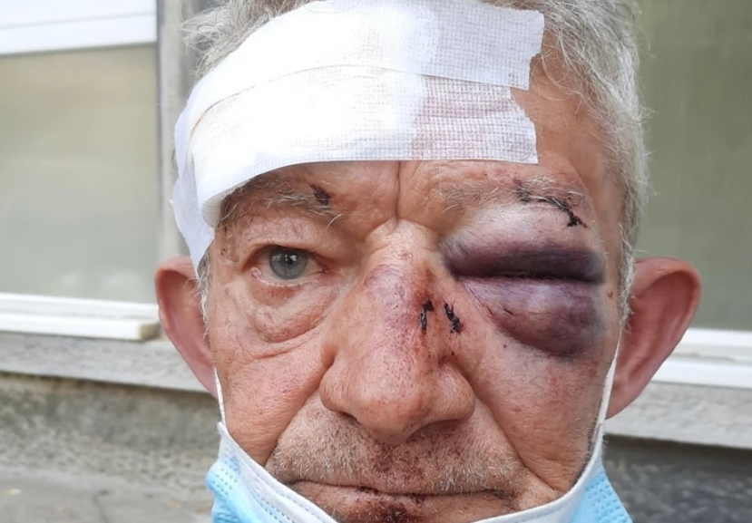 ФОТО: Син на инвеститор брутално претепал старец (69), бидејќи се пожалил поради дивоградба во Белград