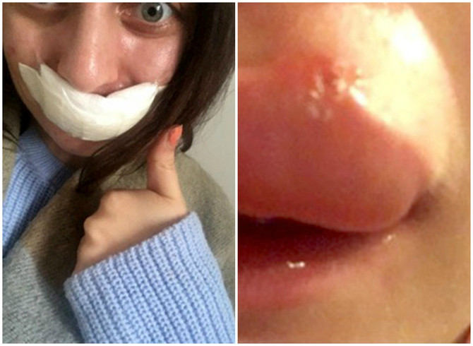 Поради нејзината усна докторите останале во шок: Дури после 7 месеци откриле што се случува со лицето на оваа девојка (ФОТО)