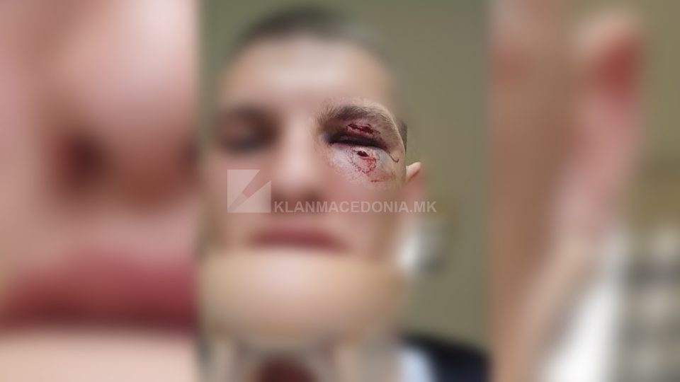 ХАОС ВО ИДРИЗОВО: Тешка пресметка помеѓу полицајци и затвореници (ФОТОГРАФИИ)