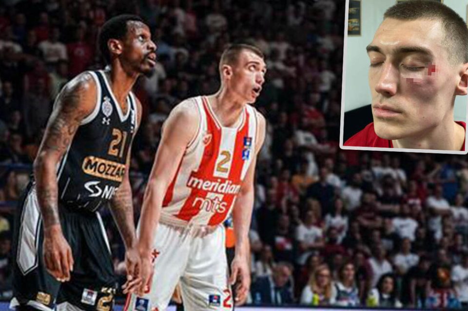 (фото 16+) НЕЗАПАМТЕН СКАНДАЛ ВО СРБИЈА: Кошаркар на Партизан му нанесе тешки повреди на кошаркар на Звезда
