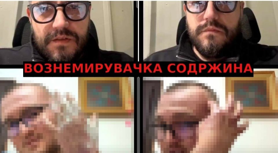 ВОЗНЕМИРУВАЧКО ВИДЕО: Еден од повредените во пожарот во Кочани ги покажа своите рани