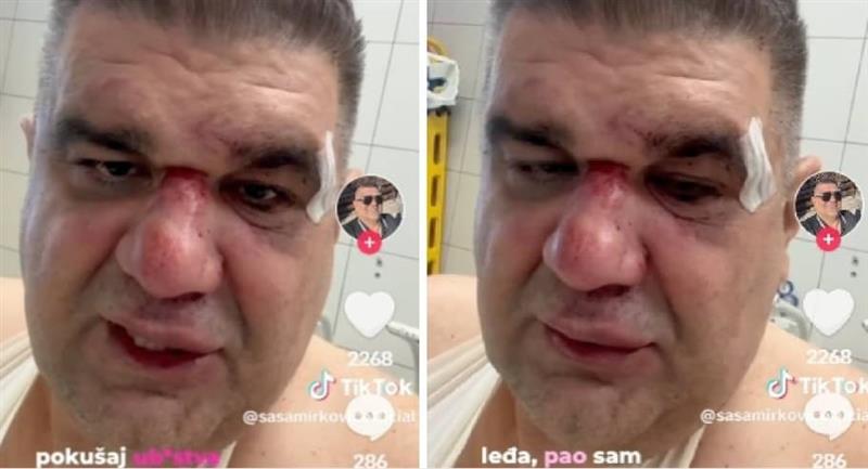 Се огласи претепаниот српски бизнисмен во Загреб – откри од кого бил шутиран