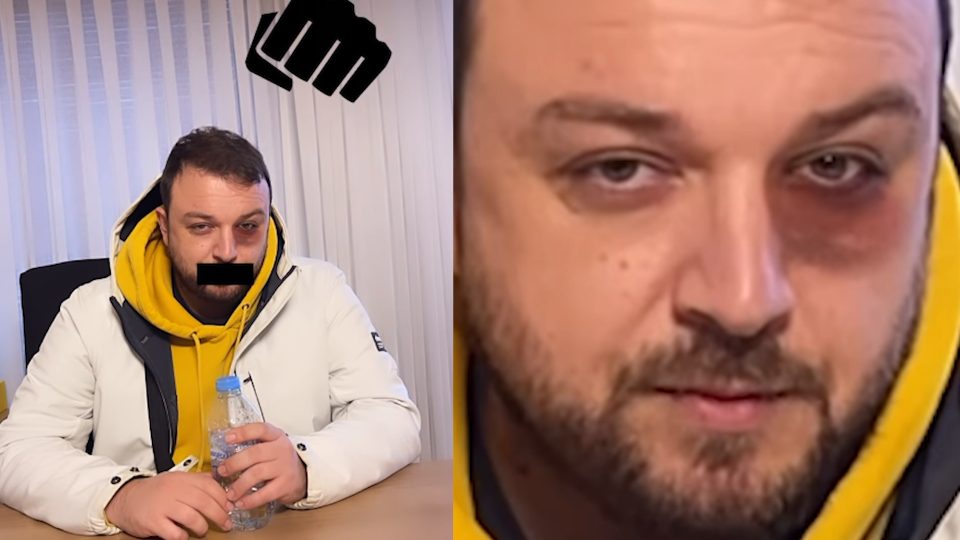 Слаткар открива како ја добил говорната маана: Не ми е тоа вродена маана, сум почнал да д’ткам поради ова