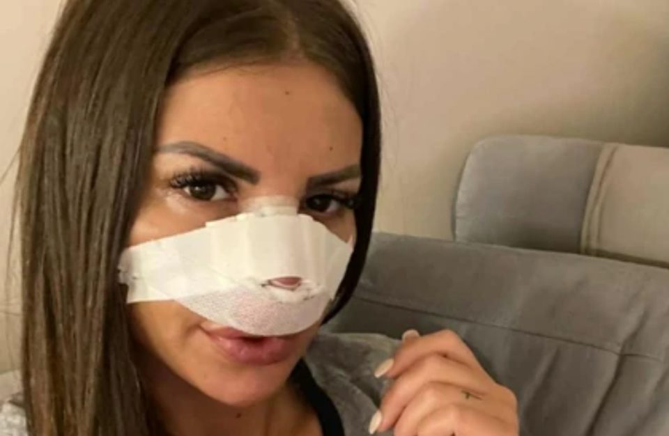 ШТО Е ОВА, ЖЕНАВА ПОВЕЌЕ НЕМА НОС: Драгана направила ОСУМ операции на носот – веќе не личи на себе (ФОТО)