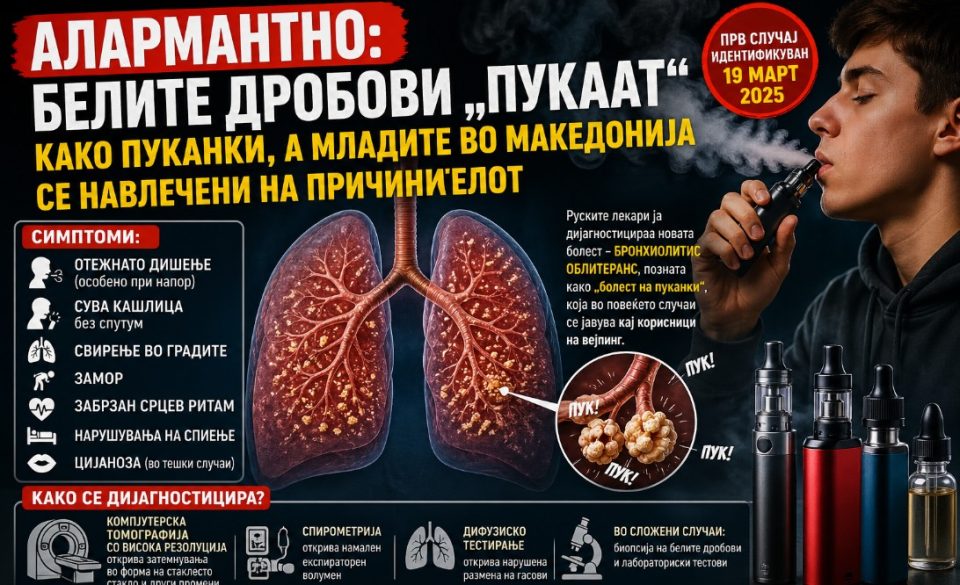 АЛАРМАНТНО: Лекарите дијагностицираа нова болест – белите дробови „пукаат“ како пуканки, а младите во Македонија се навлечени на причинителот